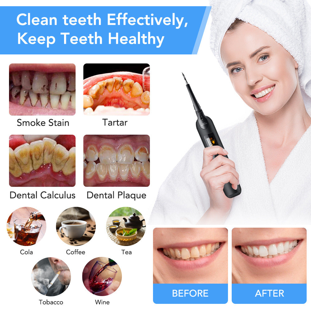 Smart Electric Tooth Cleaner for Home Use - Best Products